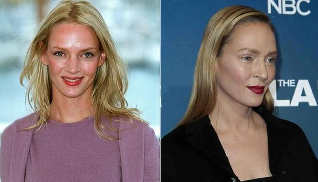 Uma Thurman Plastic Surgery: [+PHOTOS] Renee Zellweger ...